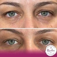 Nicoles Gesichtszauber