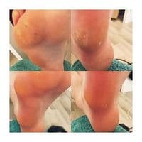 MiFee MOBILE FUßPFLEGE