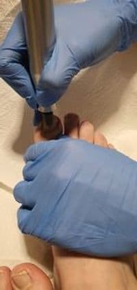 Anna Hoppermann - Fachfußpflege