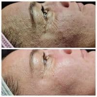 Sunbi Skin Care & Treatments Kosmetikstudio Leverkusen