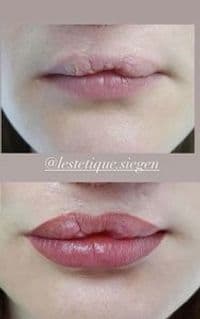 L'estetique Kosmetikstudio (Ljerka Poletan)