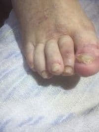 FiroZeh Fußpflege Aachen